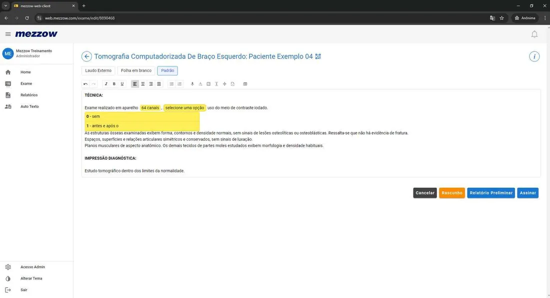 Editor de modelo de laudo no Mezzow